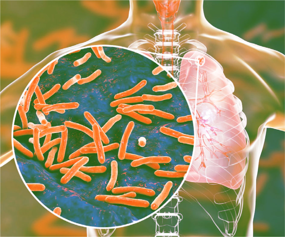 ⚜️ Туберкулездің алдын алуда флюорографияның маңызы