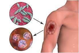 ⚜️Оба – қауіпті ауру