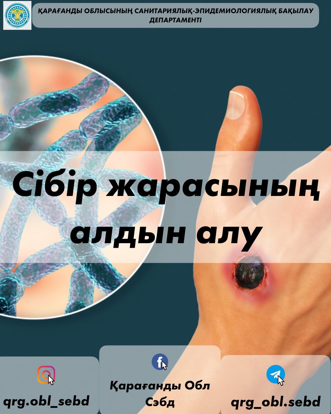 Сібір жарасының алдын алу