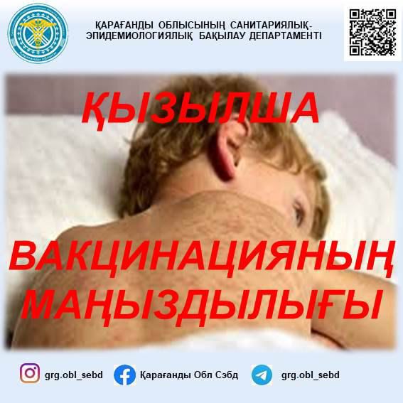 ҚЫЗЫЛША: вакцинацияның маңыздылығы